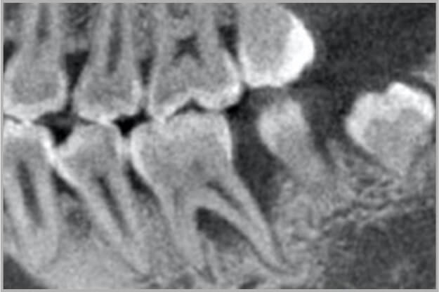 Case 04