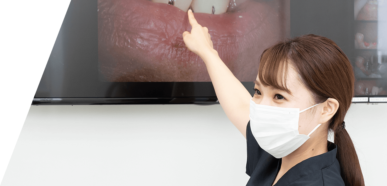 審美セラミック治療
