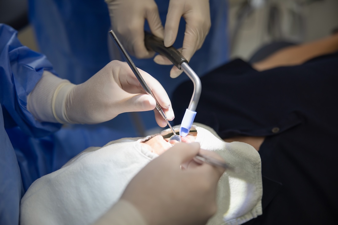 抜く前に考える、歯を残すための治療